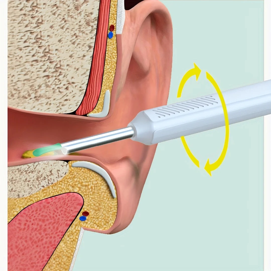 Ear Wax Removal Camera Endoscope Set 1080P HD with LED Light App Viewing USB Rechargeable 6 Spoon Heads